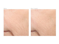 Revision Skincare Retinol Complete 0.5