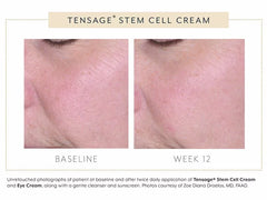 Biopelle Tensage Stem Cell Cream