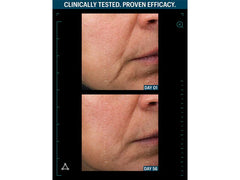 Allies of Skin Advanced Growth Factor Lifting Serum & Moisturizer Duo